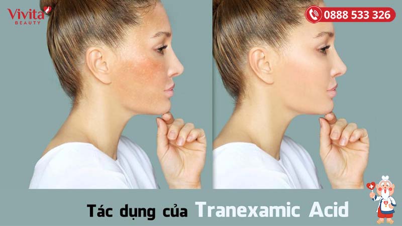 tác dụng của Tranexamic acid
